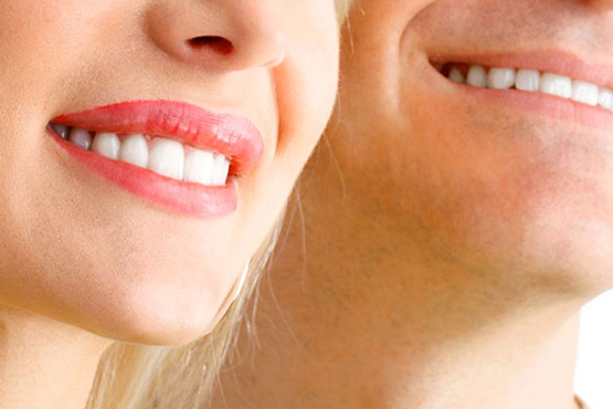 Endodoncias dentales